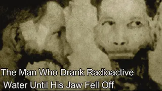 Man who consumed radioactive medicine