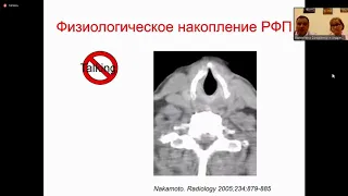 Станжевский А.А. «Применение ПЭТ-КТ в диагностике опухолей головы и шеи»