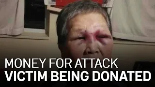 Woman Attacked in SF Wants Donation Money to Be Given to Asian American Community