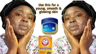 I tested Baking Soda and Vaseline and this happened || No more Acne/Pimple, Dark spot, wrinkle