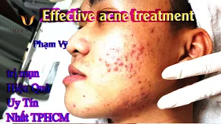 Cách Điều Trị Mụn Viêm, Mụn Bọc Hiệu Quả Nhất TPHCM Tại Hiền Vân Spa _ Phạm Vỹ I Bài 325