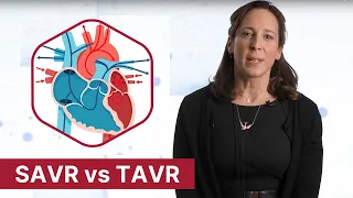 SAVR vs. TAVR: How to Decide?