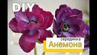 TOP 3 Options for how to do it yourself DIY Anemone Middle