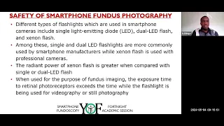 Smartphone Fundoscopy II