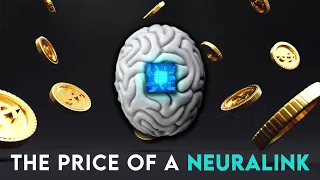 The Cost of a Neuralink Implant