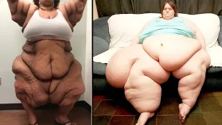 The Most Overweight People In The World