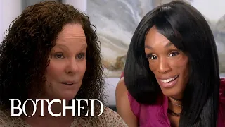 5 Botched MIRACLES From Season 5 | E!