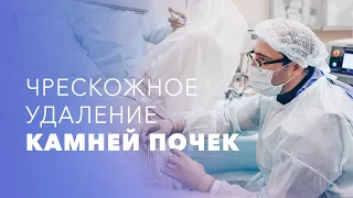 Операция по удалению камней почки. Перкутанная (чрескожная) литотрипсия