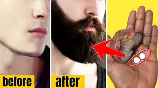 How to grow thick healthy beards in 1 week. Natural treatment to grow beards and facial hair loss