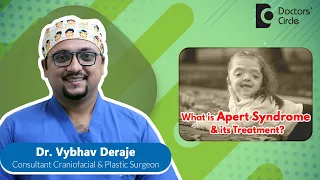 Head Shape & Treatment of APERT SYNDROME BABY #newborn  - Dr. Vybhav Deraje| Doctors' Circle