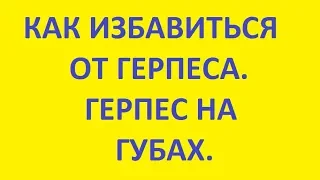 Как избавиться от герпеса. Герпес на губах.