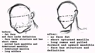 cherry reuploads defined face shape subliminal