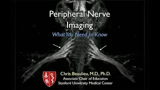 Peripheral Nerve Imaging: What You Need to Know