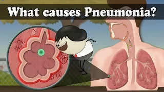 What causes Pneumonia? | #aumsum #kids #science #education #children