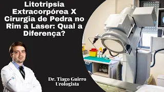 Litotripsia Extracorpórea X Cirurgia de Pedra no Rins a Laser: Qual a Diferença?