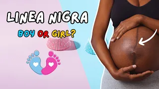 Pregnancy Belly Line | Can the Linea Nigra Predict Your Baby's Gender | Boy or Girl Gender