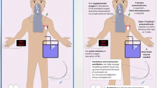 Trauma Part 5 - Breathing - Management in Trauma Patients