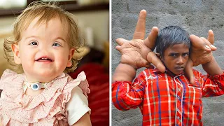 Top 9 Niños Más Inusuales y Extraños Que Existen en el Mundo