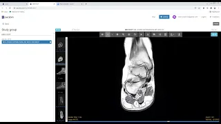 MRI FOOT TUTORIAL:  How to read a foot MRI?