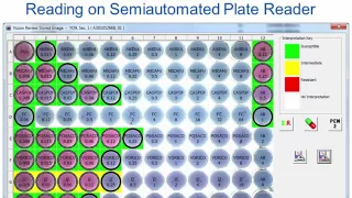 Cut-off Values and Species-Specific Breakpoints [Hot Topic]