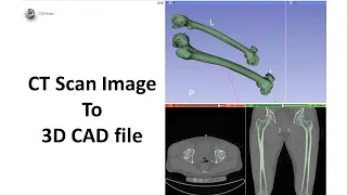 How to convert CT scan to 3D CAD Model