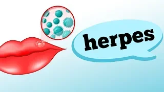 HERPES LABIAL: COMO SE PEGA O VÍRUS?