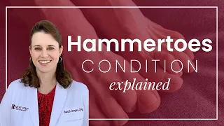 What Are Hammertoes?