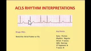 ACLS EKG Rhythms 2016 - Interpretations and managements by NIK NIKAM MD