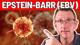 Epstein-Barr Virus Behandlung - was kann man tun?!