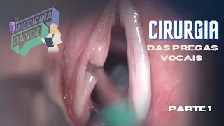 Cirurgia de Cordas Vocais ( Microcirurgia de Laringe)