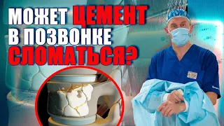 Обзор цемента для вертебропластики позвоночника! Нейрохирург