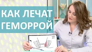 ЧТО ТАКОЕ ГЕМОРРОЙ