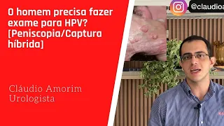 O homem precisa fazer exame para HPV? [Peniscopia/Captura híbrida]