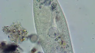 Zoom 400x.Pantofelek i jego wnętrze.Domowa mikroskopia. Microscope.Microscopy.