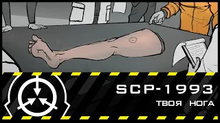 SCP-1993 — Твоя нога | SCP-объекты