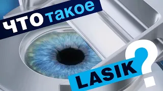 Что такое LASIK?