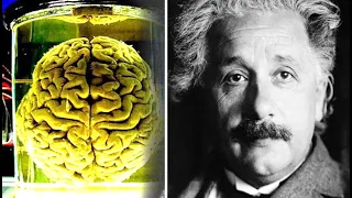 The Sad Story of How Einstein’s Brain Was Stolen Even Though He Gave Specific Orders