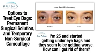 Temporary and Permanent Treatments for Puffy Under Eye Bags