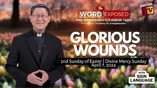 GLORIOUS WOUNDS |  The Word Exposed with Cardinal Tagle (April 7, 2024)