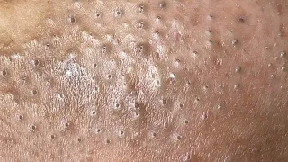 Satisfying and Relaxation with NaSa Beauty Spa Video #45