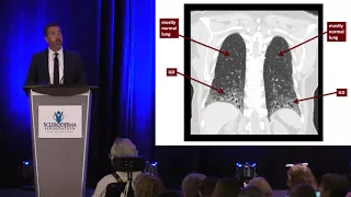 Evaluation and Management of Scleroderma Lung Disease- Aryeh Fischer, M.D.- 2017