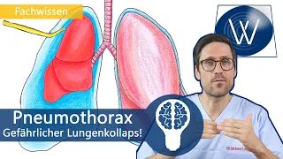 Pneumothorax: Luftnot & Brustschmerzen? Lebensgefahr bei Lungenkollaps! Ursachen, Symptome, Therapie