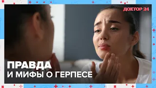 Правда и мифы о ГЕРПЕСЕ | Доктор 24