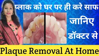 प्लाक को घर पर ही कैसे साफ करें? |How To Remove Plaque At Home |Danto Ka Plaque Kaise Hataye