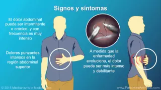 Pancreatitis crónica