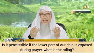 Is it permissible if lower part of my chin is exposed while praying? - assim al hakeem