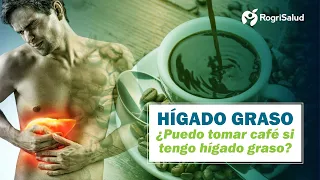 ¿Puedo tomar café si tengo hígado graso?