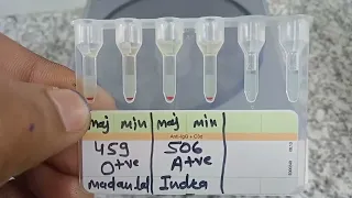 @medicallabtechnologist6489 Blood Crossmatch (Gel card method) #Ag-Ab_Reaction #MLT #lab #Blood