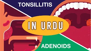 What is Adenoids and Tonsillitis? (Complete Video) | Adenoids and Tonsillitis Kia Hain? | Urdu/Hindi