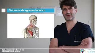 Dott. Alessandro Sacchelli - Sindrome da egresso toracico